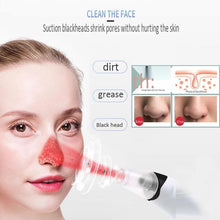 Cargar imagen en el visor de la galería, Extractor de acné eléctrico por vacío, Barros limpiador de poros negros, máquina limpiadora de poros para el cuidado de la piel mod ZH43 - mychinashop.com