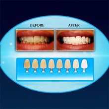 Cargar imagen en el visor de la galería, Limpiador Dental de 20 minutos, Kit de blanqueamiento Dental con luz fría, luz LED, cuidado de salud bucal, Belleza - mychinashop.com
